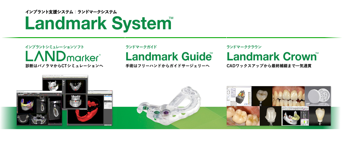 Landmark System